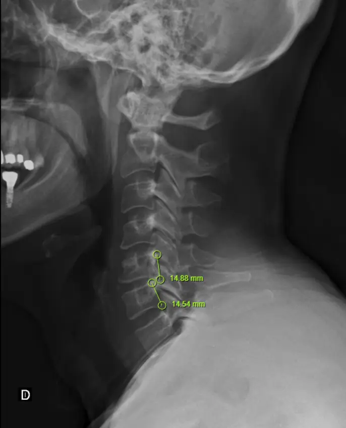 Cuidado Quiropractico Lic Martin Carpinetto